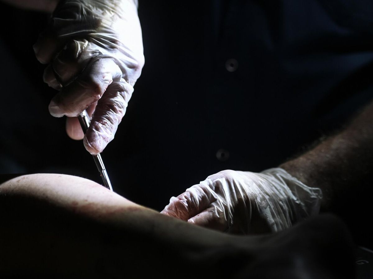 „Doktor Mengele des Kiewer&nbsp;Regimes“